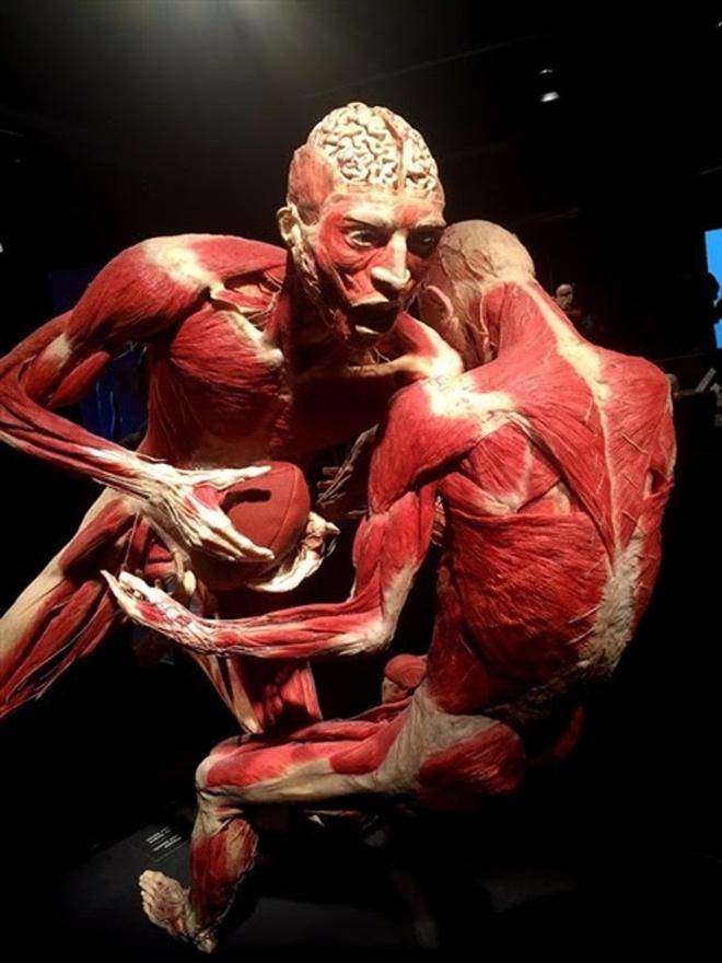 The girls and I went to see Dr. Gunther von Hagens’ BODY WORLDS: Pulse exhibiton at the Science centre here in LA.  This was a convergence of aesthetic anatomy, health and wellness and this special exhibition presented real human bodies in sickness and health and was, well a real eye opener.  Maybe time to give up the fags! © pendanablog.com